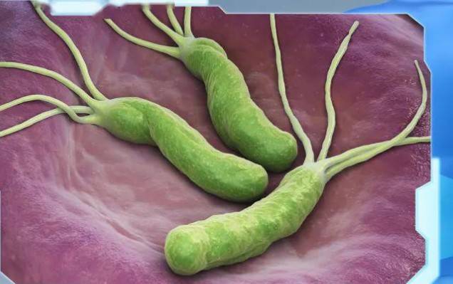 常备1种"养胃王",每天吃1点它,胃再也不痛,3周清除胃部细菌_螺旋杆菌