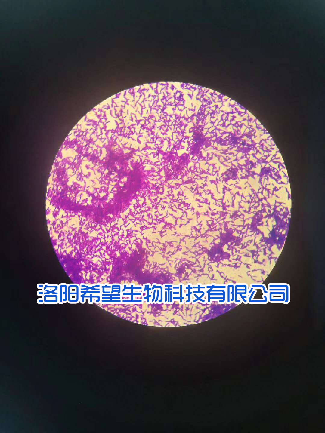 如何辨别真假凝结芽孢杆菌?_肠道