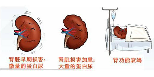 脾肾虚衰,则不能化气行水,升清降浊,水