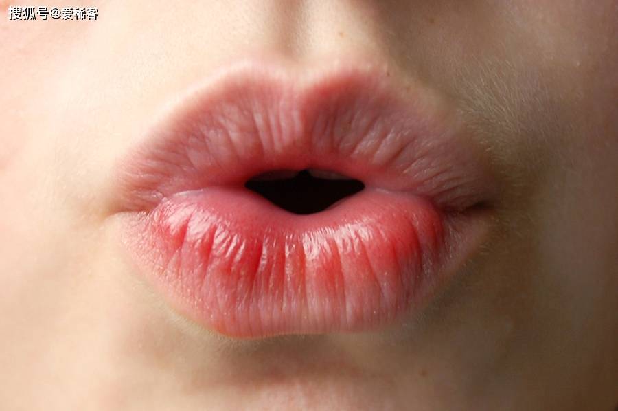 干货| 肺动脉高压患者的居家护理