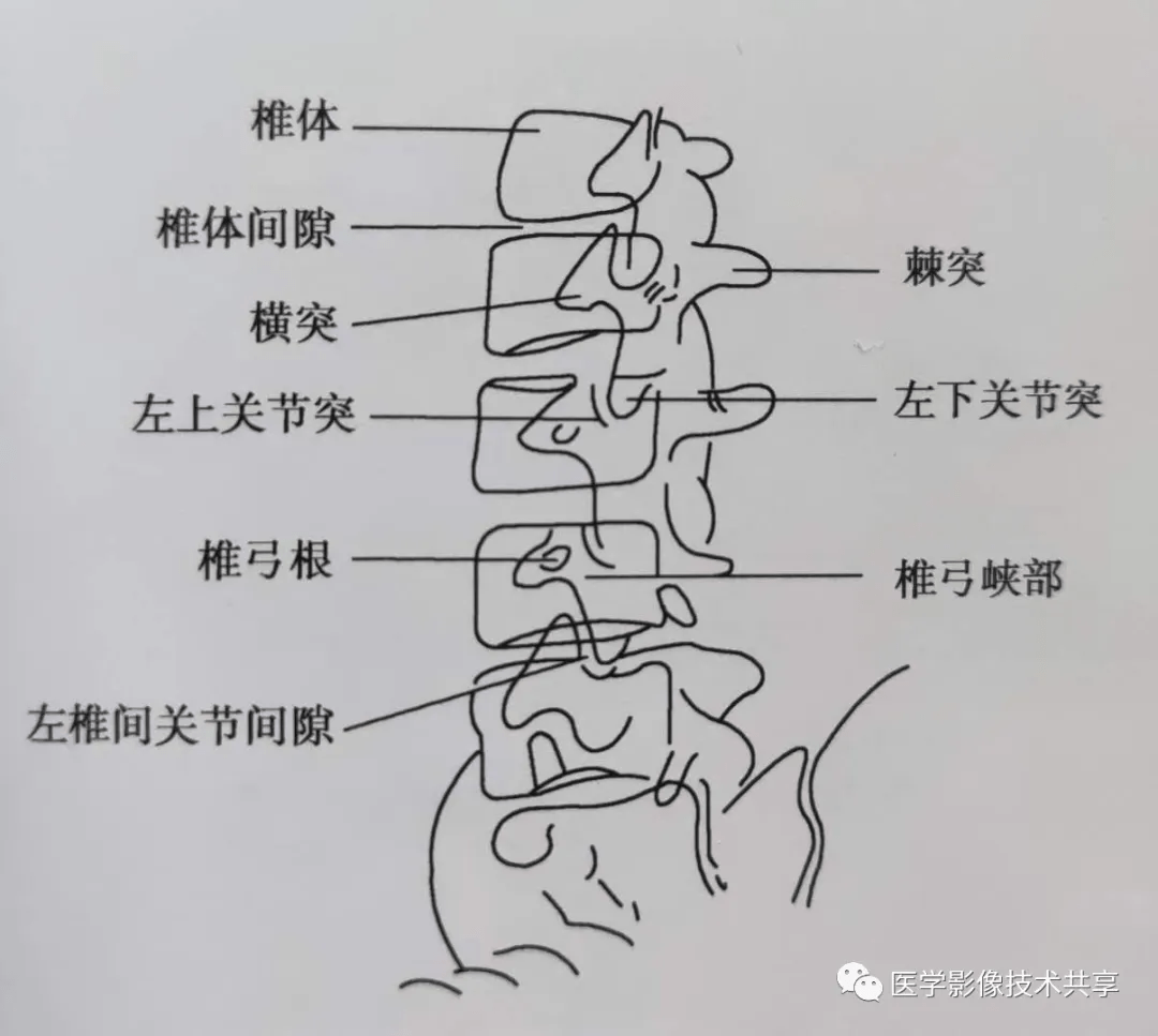 普放解析:腰椎斜位片