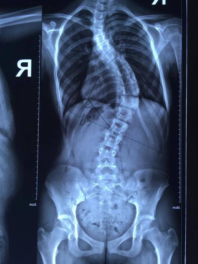 5 小时,28 颗钉子,12 岁女孩打开「折叠人生」
