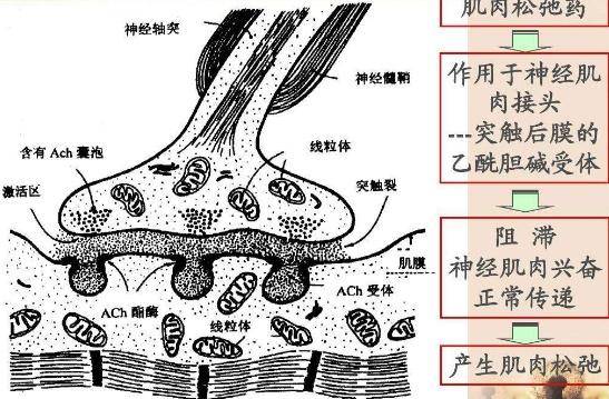 手術時全身麻醉後人怎樣醒過來麻醉為何會使有的人身體沒知覺