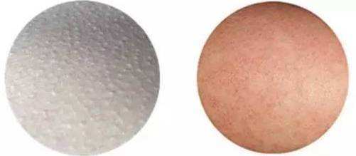 紧急遮盖鸡皮肤(鸡皮肤夏天怎么遮掉) 紧急遮盖鸡皮肤(鸡皮肤夏天怎么遮掉)