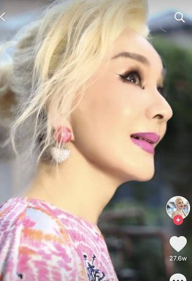 失忆40岁独子后,71岁夏台凤晒近照,满脸白发疑整容