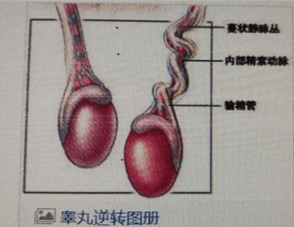 少年下身又红又肿,家人焦头烂额,专家检查后:现在只能切除了