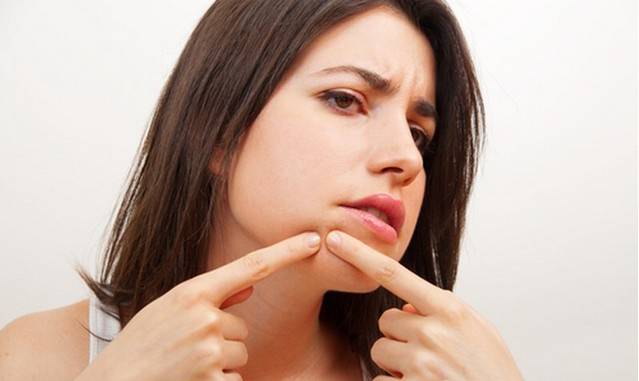 女孩挤痘痘引发颅内感染,一颗小小的痘痘竟能危及生命?