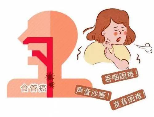 為什麼食道癌一發現就是晚期這三個明顯症狀你卻忽略了