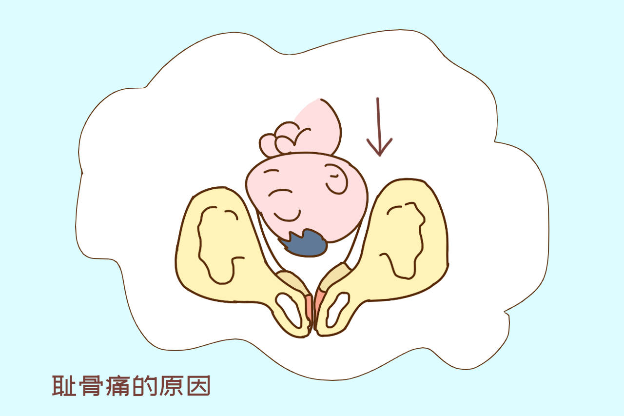 原创孕期耻骨疼痛准妈妈没必要强忍着以下方式可有效缓解