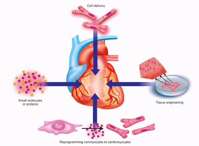干细胞治疗心脏病有效吗证据都在这了