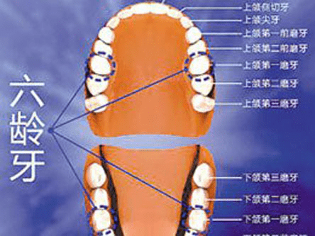 福州恆牙的先驅者六齡牙