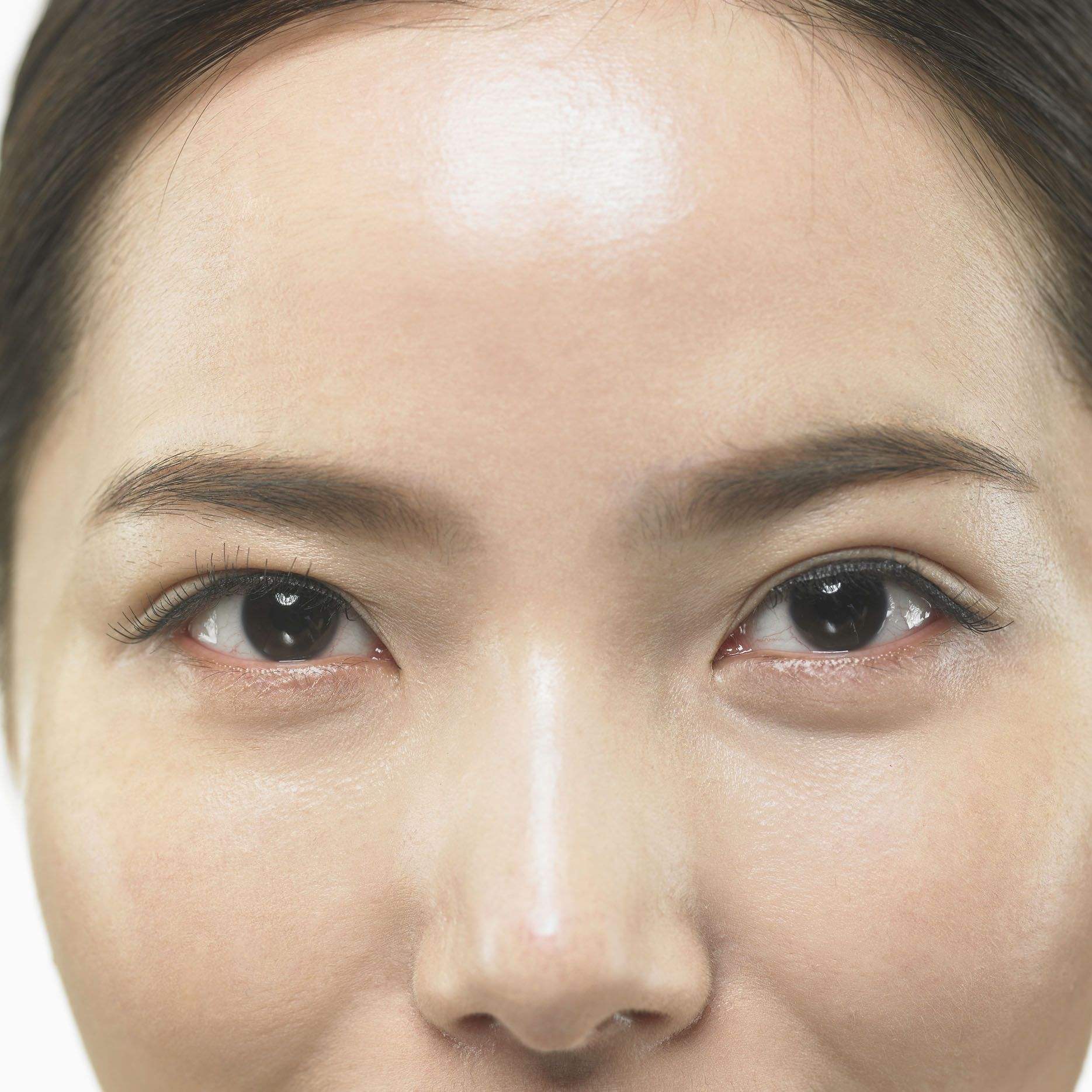 从源头出发解决问题 量肤定制 油皮肌护理全攻略_手机搜狐网