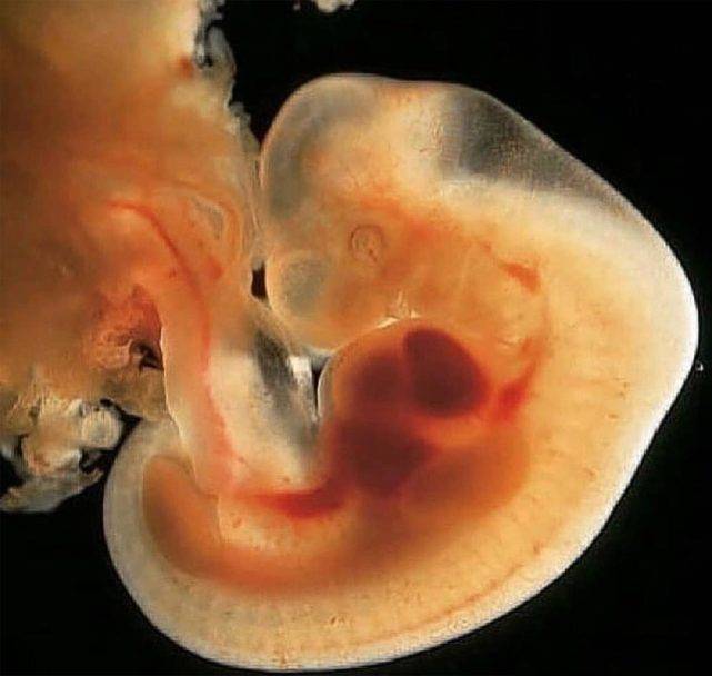 怀孕60天胚胎图片高清图片