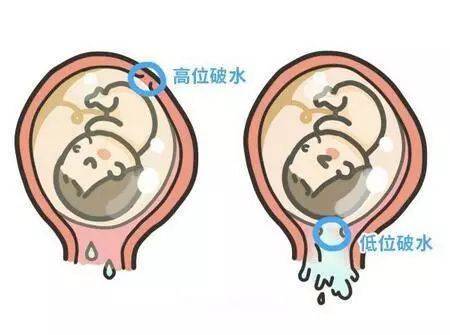 胎儿在宫内的时候,周围包着一层薄薄的膜,叫做胎膜,胎膜内有叫做羊水