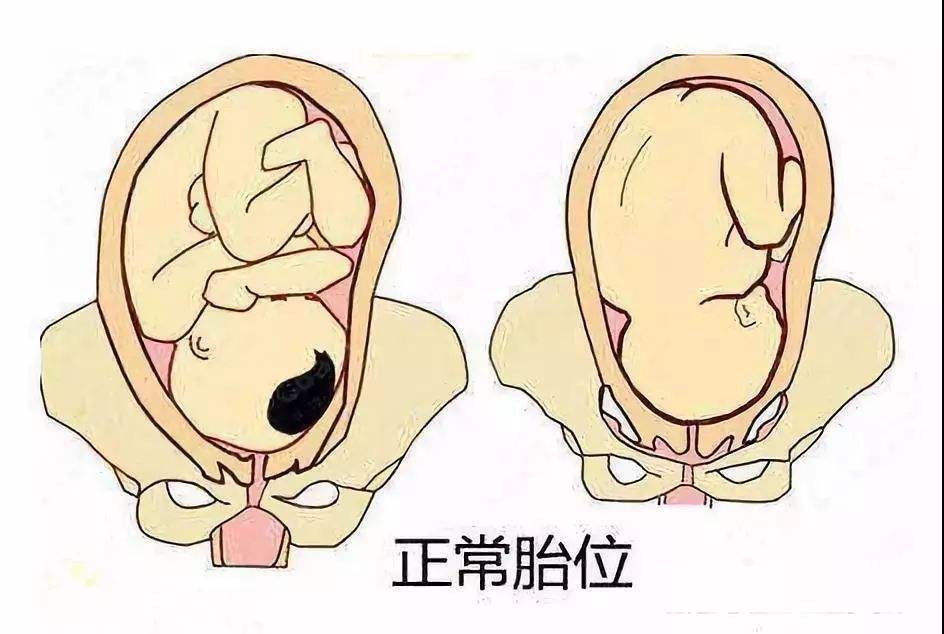 左枕横位真人胎儿图图片