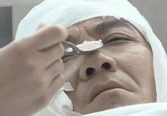 原创亮剑同样是李云龙住院老版嘴唇发白一脸病态新版一看就是装的