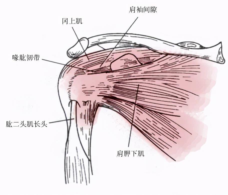 肩袖又叫旋转袖,是包绕在肱骨头周围的一组肌腱复