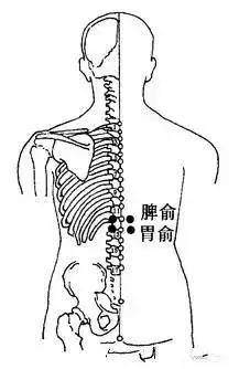 拔罐治疗慢性胃炎效果竟然那么好