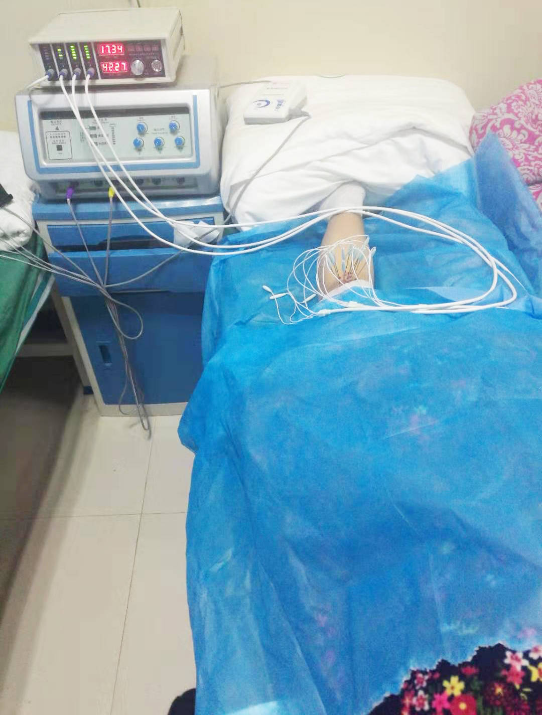 什么是内热针?_手机搜狐网