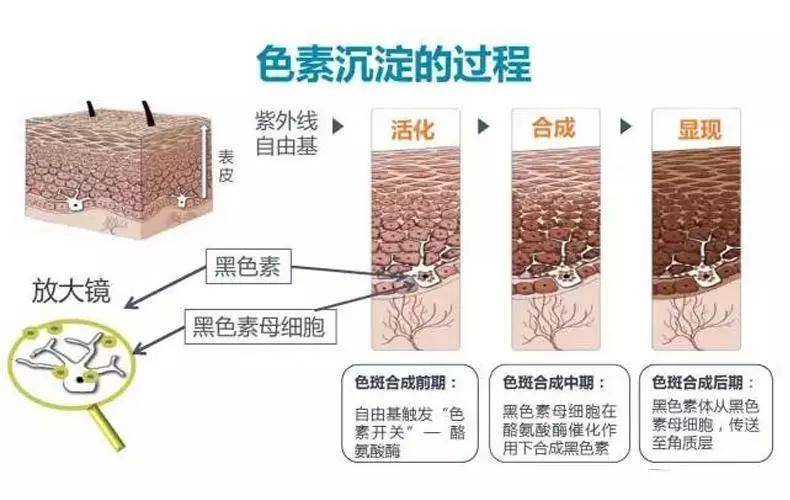 如何有效祛斑?_黑色素