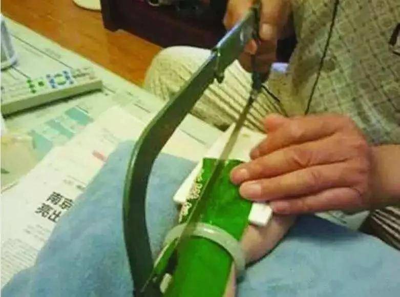 保貓還是保鐲子？小貓咪被3萬的金鐲子卡住腦袋……