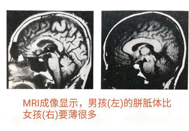 原创男孩开窍晚7岁前用3招来训练胼胝体帮助孩子尽早开窍
