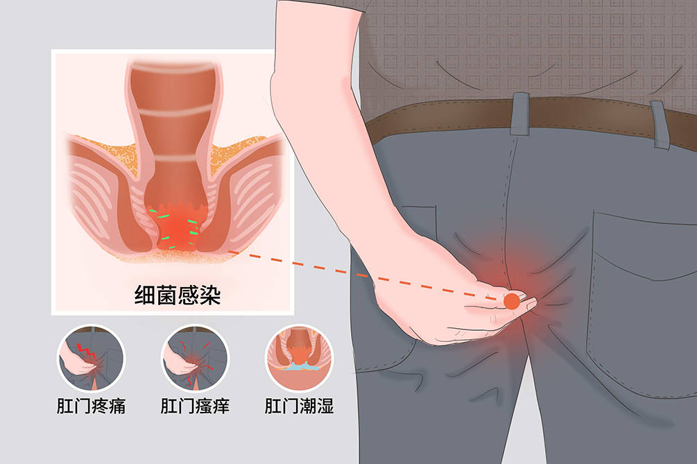 男生肛门非常非常疼图片