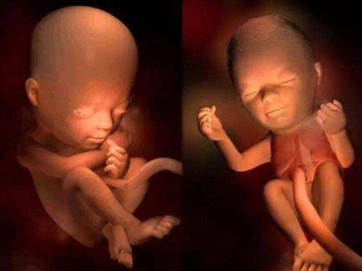 孕20周胎儿多大图片