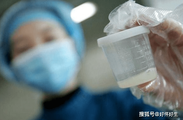 精子越多越好吗?