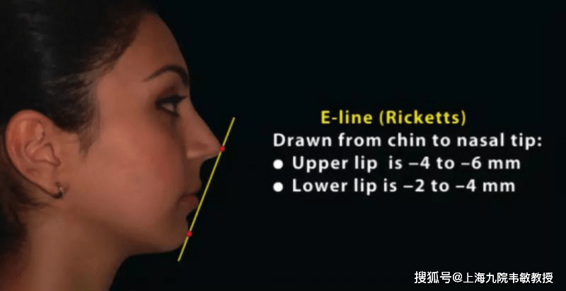 矫正嘴凸大概要多少钱_矫正嘴凸有风险吗_凸嘴如何矫正