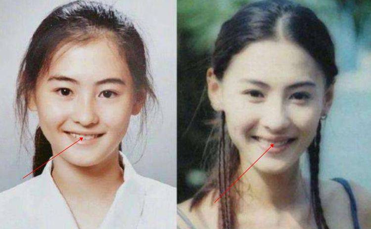 整牙等于"毁容"?张柏芝曾花高价做烤瓷,五官的和谐都被破坏了