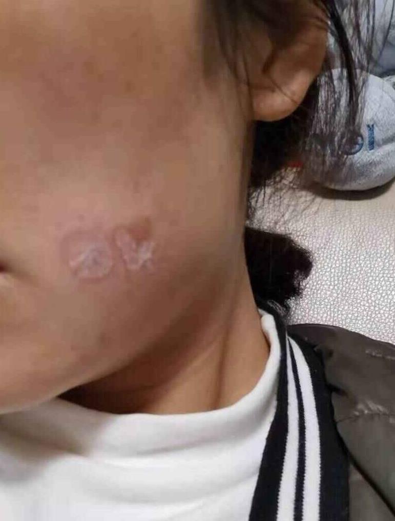 是美容还是毁容长沙新合新颐美遭投诉回应称正常现象
