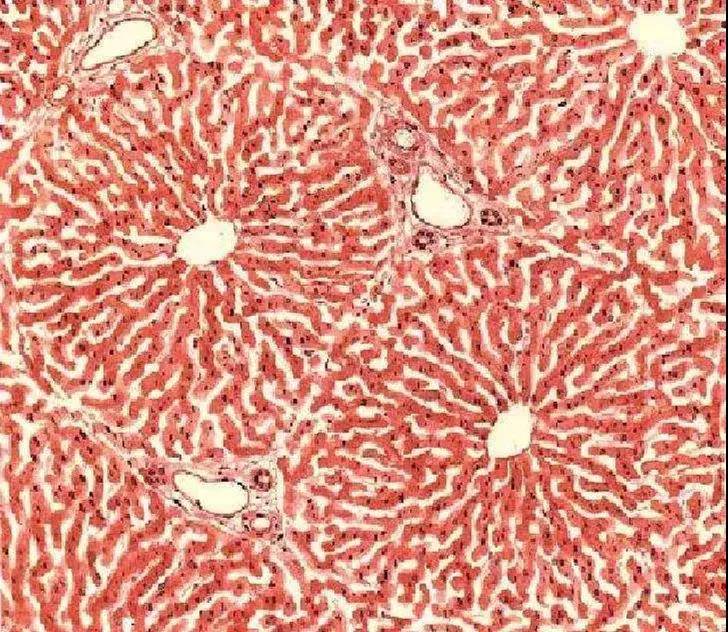 患上乙肝为何难治愈