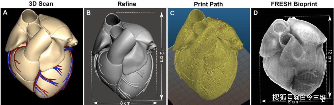 3d生物打印全尺寸人體心臟的模型