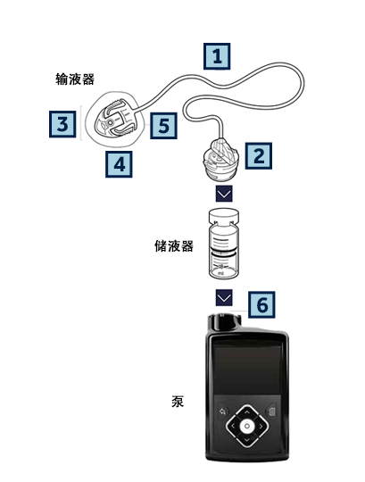 糖友福音:关于胰岛素泵你知道吗?
