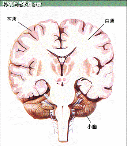 熟悉又陌生的脑白质病变,老年人请注意!