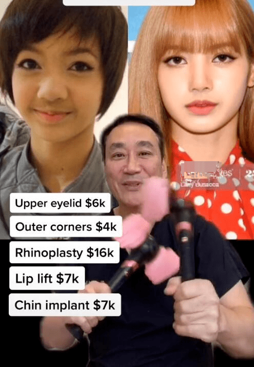 美国整容医生分析明星整容:lisa隆鼻下巴植入假体?金智妮做双眼皮?