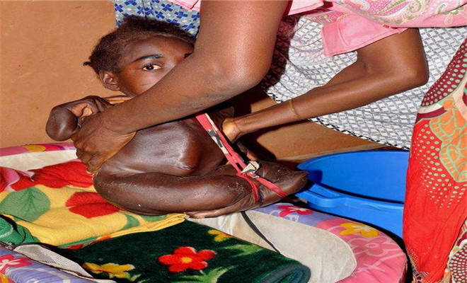 19岁的她出生就和别人与众不同吃喝拉撒只能在盆里坚持19年