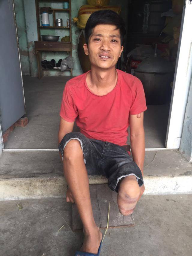 残疾男子与妻子生下低智儿子又要二胎,结果孩子刚出生就查出癌症