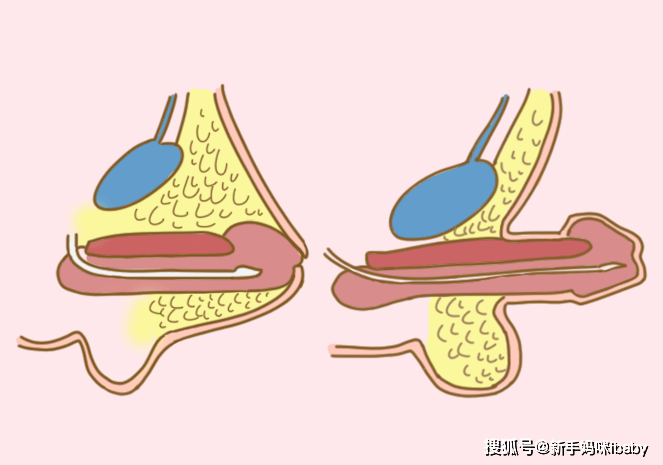 小孩小鸡正常标准图片