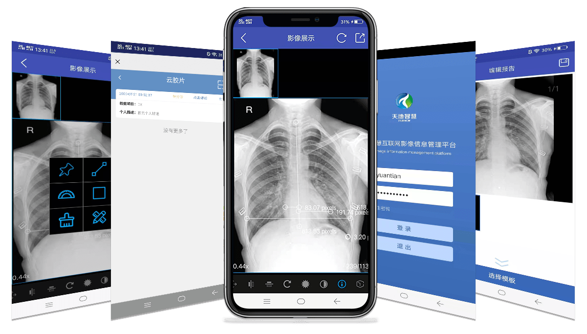 什么样云胶片才是标准安全的云胶片