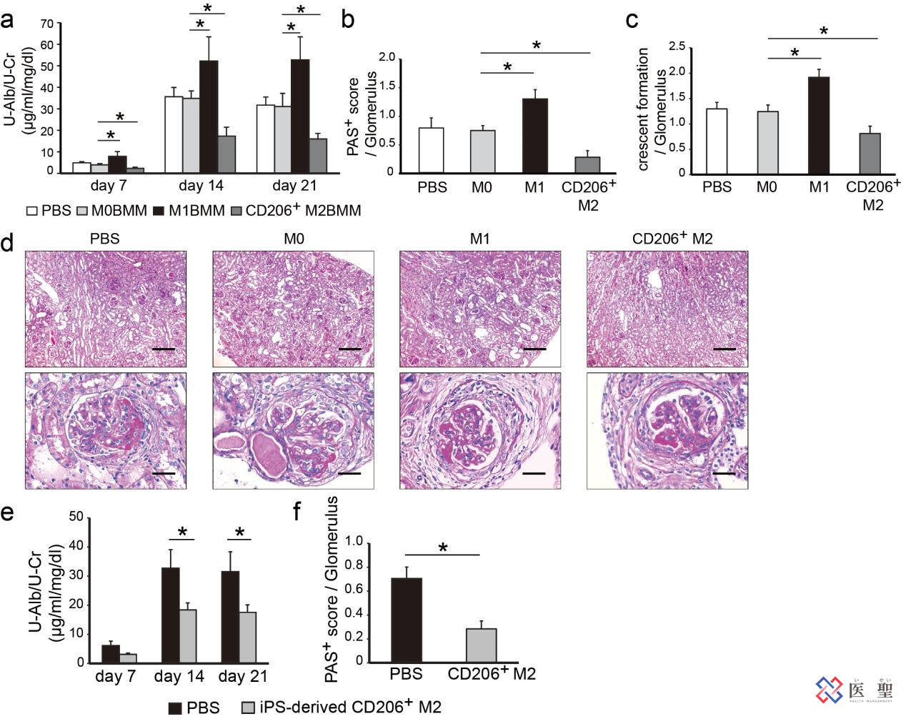 红细胞|ISEI日本干细胞—脂肪由来间充质干细胞治疗急性肾炎