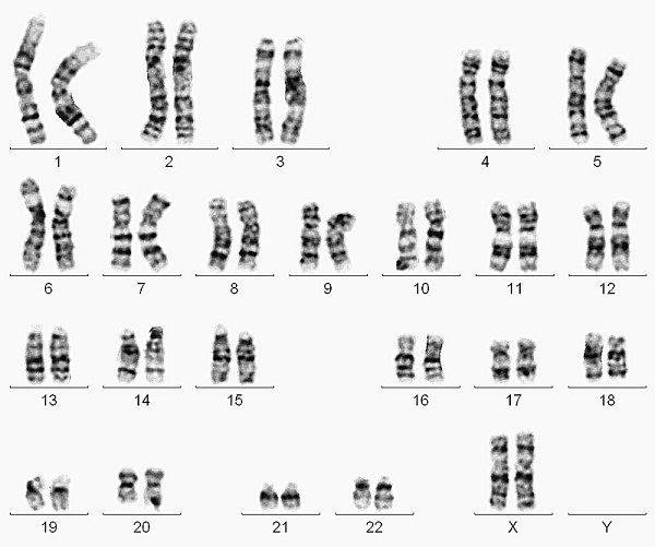 女孩染色体图女性图片