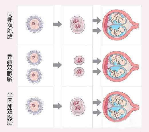 异卵双胞胎怀孕卡通图片