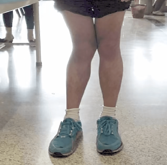 原创孩子走路"内八"or"外八",可能和这 3 个小习惯有关!