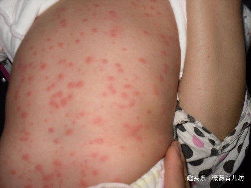 五岁孩子总说浑身痒,医生的话,让孩子无奈道出了实情