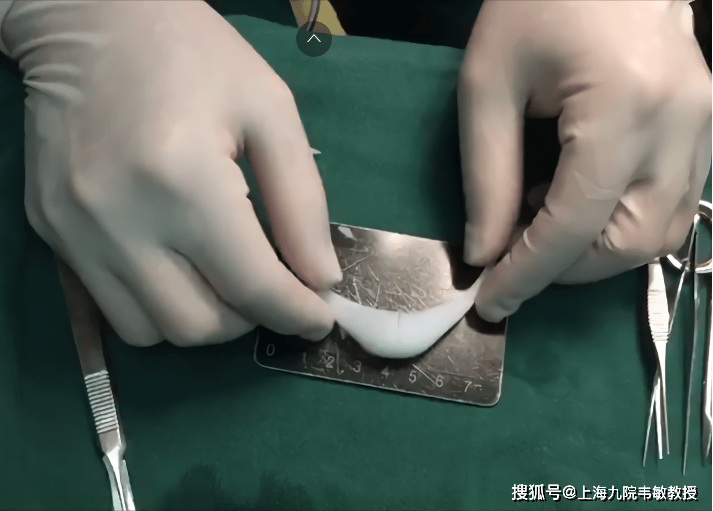 九院韦敏案例丨舒铂隆下巴好吗?这组舒铂隆颏案例告诉你答案