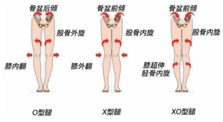 荒野健康xo型腿如何靠按摩或锻炼矫正