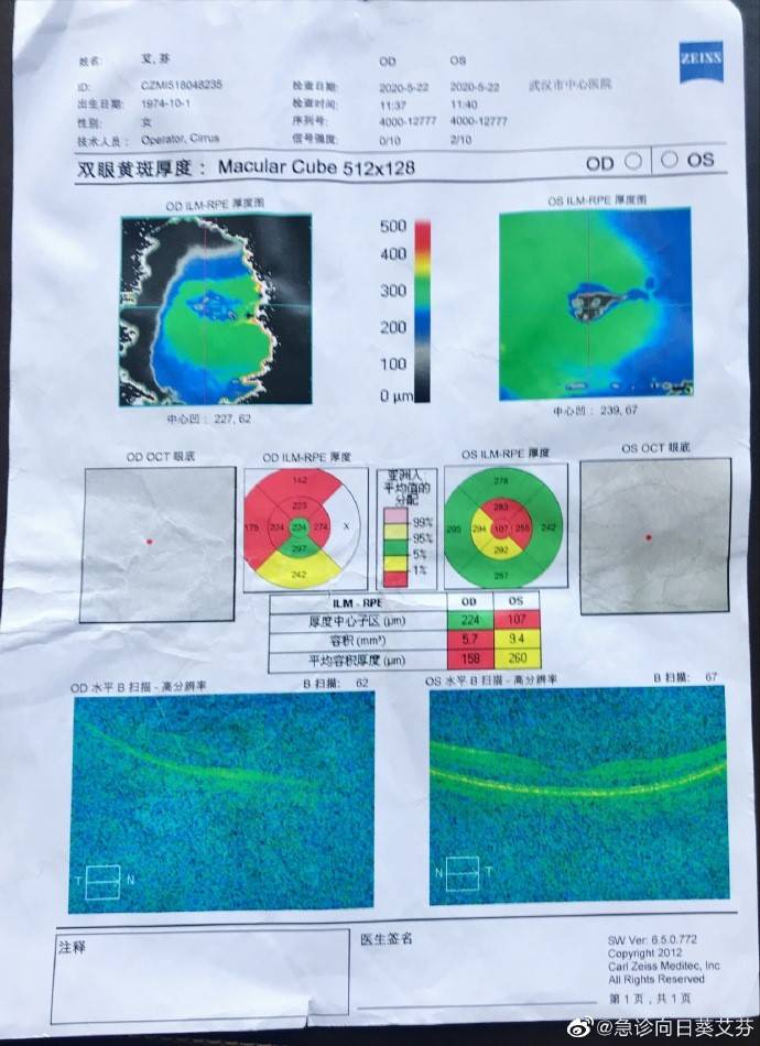 oct檢查結果和現有的全部病歷,一位北方頂級醫院的三甲醫院眼科主任