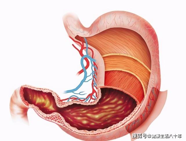 胃不好的人,饭后容易出现3种表现,占一个,最好检查一下